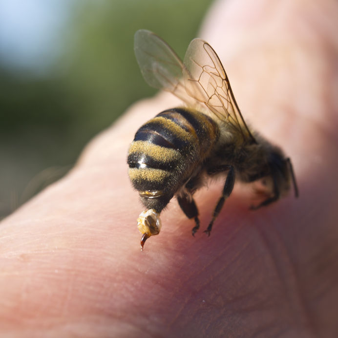 Doctors Warning About Honeybee Sting Acupuncture