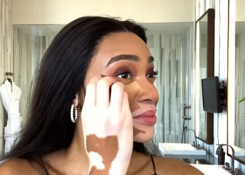 Learn Winnie Harlow's Honey Skincare Hack to Treat Redness